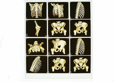 Poręczne obrazowanie diagnostyczne rentgenowskie z białą podstawą, medyczna niebieska folia rentgenowska