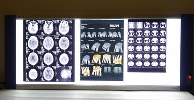 10-calowe * 14-calowe cyfrowe rentgenowskie filmy medyczne do drukarek termicznych KND-F