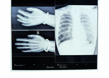 Good price Odporne na ciepło obrazowanie Konida Medical Dry Film o wysokiej rozdzielczości w Internecie