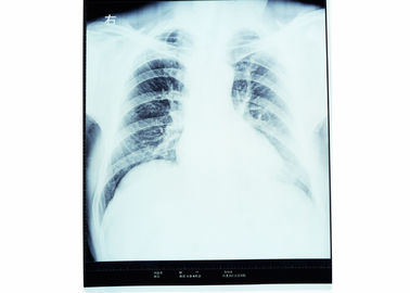 Medyczne diagnostyczne obrazowanie o wysokiej ostrości, suchy film rentgenowski AGFA