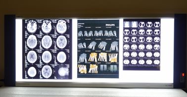 Good price Bright Medical X Ray Dry Folia do drukarki termicznej Laser Niebieska podstawa w Internecie