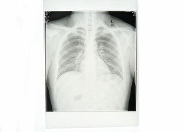 Biała papierowa skrzynia medyczna Folia rentgenowska Wodoodporna wysoka ostrość