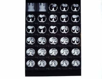 Medyczne filmy rentgenowskie, sucha folia obrazująca kompatybilna z drukarką termiczną do CT / DR / MRI
