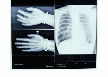10 x 14 cali suchych medycznych promieni rentgenowskich do Fuji 3000/2000/1000