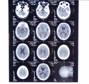 11-calowe * 14-calowe suche rentgenowskie filmy do obrazowania medycznego KND-A dla AGFA 5300, 5302, 5500, 5502, 3000