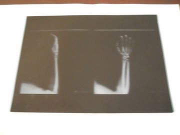 Niska mgła KND-A Medical Dry Imaging Film do badania rentgenowskiego na AGFA 5300 11 cali × 14 cali