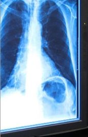 Niebieska, sucha, rentgenowska folia do obrazowania medycznego 11 cali x 17 cali do drukarek termicznych